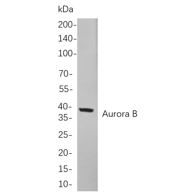 WR4134 Western blot analysis of lysates from K562 cells, using Aurora B Rabbit mAb. The HRP-conjugated Goat anti-Rabbit IgG antibody (WS0002) was used to detect the antibody. Western blot analysis of lysates from K562 cells, using Aurora B Rabbit mAb. The HRP-conjugated Goat anti-Rabbit IgG antibody (WS0002) was used to detect the antibody.