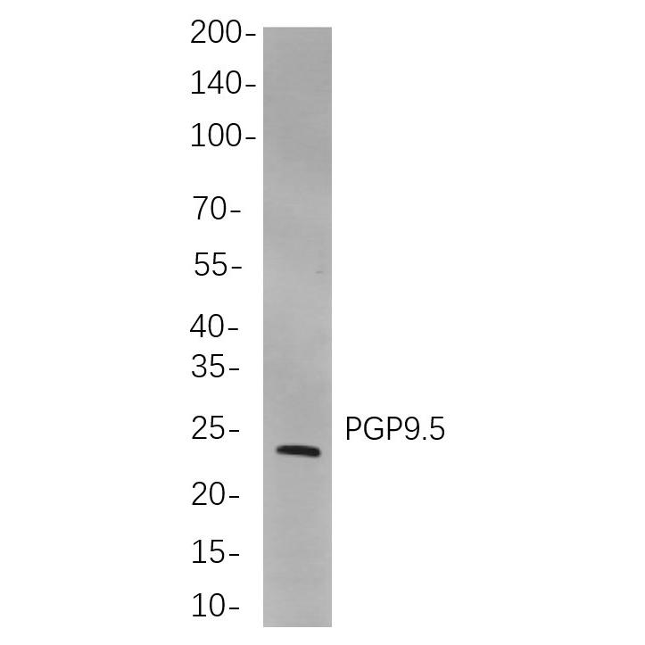 WR4139 Western blot analysis of lysates from SH-SY5Y cells, using PGP9.5 Rabbit mAb. The HRP-conjugated Goat anti-Rabbit IgG antibody (WS0002) was used to detect the antibody. Western blot analysis of lysates from SH-SY5Y cells, using PGP9.5 Rabbit mAb. The HRP-conjugated Goat anti-Rabbit IgG antibody (WS0002) was used to detect the antibody.