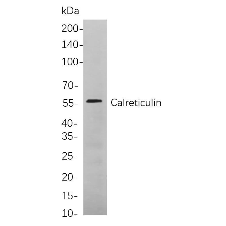 WR4141 Western blot analysis of lysates from NIH-3T3 cells, using Calreticulin Rabbit mAb. The HRP-conjugated Goat anti-Rabbit IgG antibody (WS0002) was used to detect the antibody. Western blot analysis of lysates from NIH-3T3 cells, using Calreticulin Rabbit mAb. The HRP-conjugated Goat anti-Rabbit IgG antibody (WS0002) was used to detect the antibody.