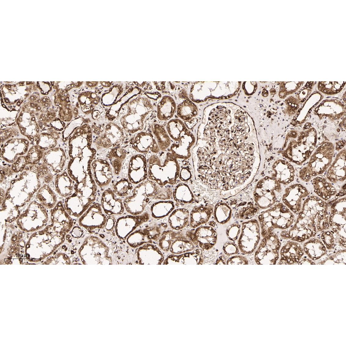 WR4141 Immunohistochemical analysis of paraffin-embedded human kidney tissue. 1, primary Antibody was diluted at 1:200(4~C,overnight). 2, EDTA pH 9.0 was used for antibody retrieval(>98~C,20min). 3,Secondary antibody was diluted at 1:200(room tempeRature, 30min). Immunohistochemical analysis of paraffin-embedded human kidney tissue. 1, primary Antibody was diluted at 1:200(4~C,overnight). 2, EDTA pH 9.0 was used for antibody retrieval(>98~C,20min). 3,Secondary antibody was diluted at 1:200(room tempeRature, 30min).