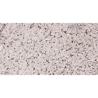 Immunohistochemical analysis of paraffin-embedded Human liver tissue. 1, primary Antibody was diluted at 1:200(4～C,overnight). 2, EDTA pH 9.0 was used for antibody retrieval(>98～C,20min). 3,Secondary antibody was diluted at 1:200(room tempeRature, 30min).