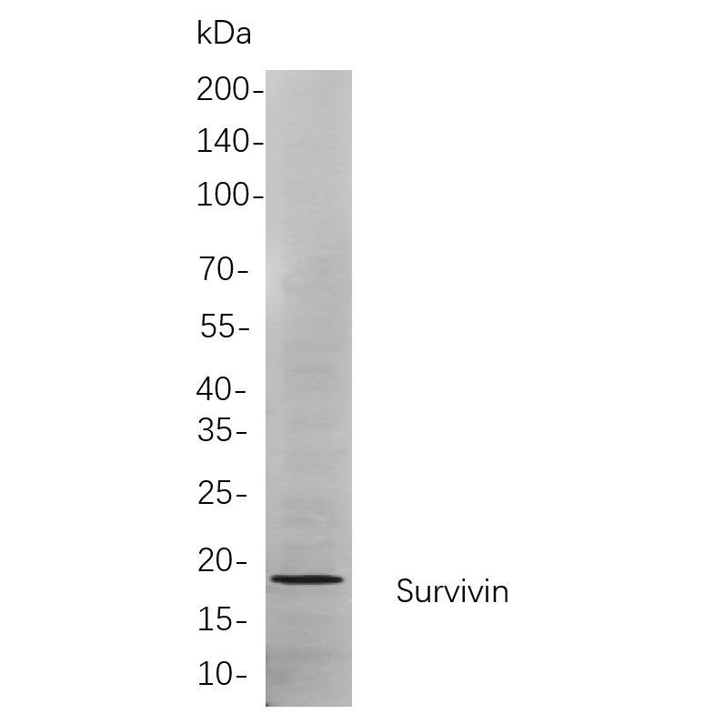 WR4146 Western blot analysis of lysates from Jurkat cells, using Survivin Rabbit mAb. The HRP-conjugated Goat anti-Rabbit IgG antibody (WS0002) was used to detect the antibody. Western blot analysis of lysates from Jurkat cells, using Survivin Rabbit mAb. The HRP-conjugated Goat anti-Rabbit IgG antibody (WS0002) was used to detect the antibody.
