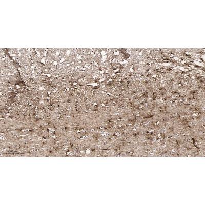 Immunohistochemical analysis of paraffin-embedded Rat brain tissue. 1, primary Antibody was diluted at 1:200(4～C,overnight). 2, EDTA pH 9.0 was used for antibody retrieval(>98～C,20min). 3,Secondary antibody was diluted at 1:200(room tempeRature, 30min).