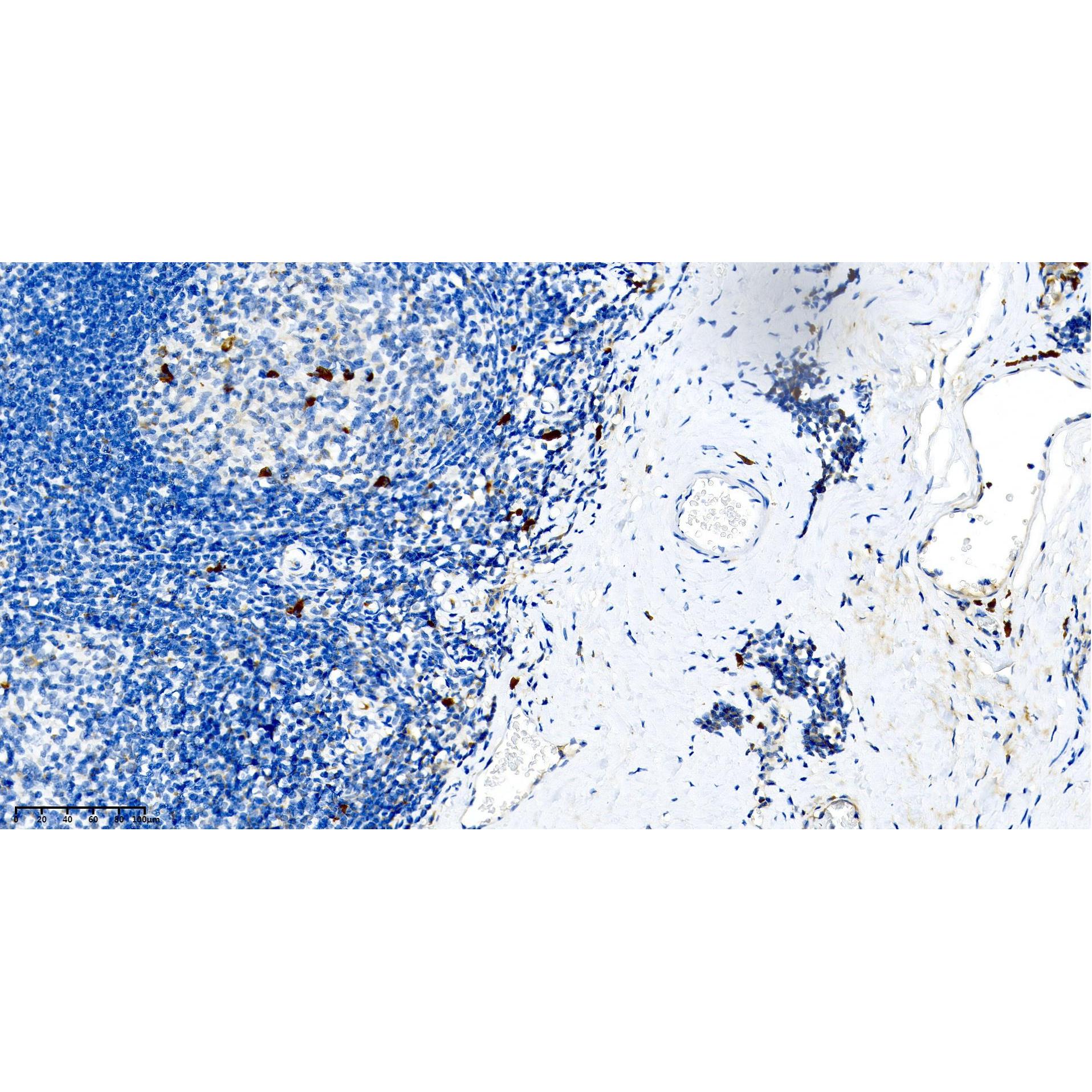 WR4154 Human tonsils WR4154 Human tonsils