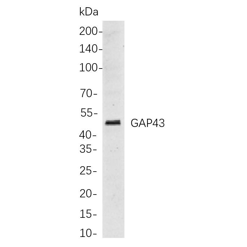 WR4157 Western blot analysis of lysates from U-87 MG cells, using GAP43 Rabbit mAb. The HRP-conjugated Goat anti-Rabbit IgG antibody (WS0002) was used to detect the antibody. Western blot analysis of lysates from U-87 MG cells, using GAP43 Rabbit mAb. The HRP-conjugated Goat anti-Rabbit IgG antibody (WS0002) was used to detect the antibody.