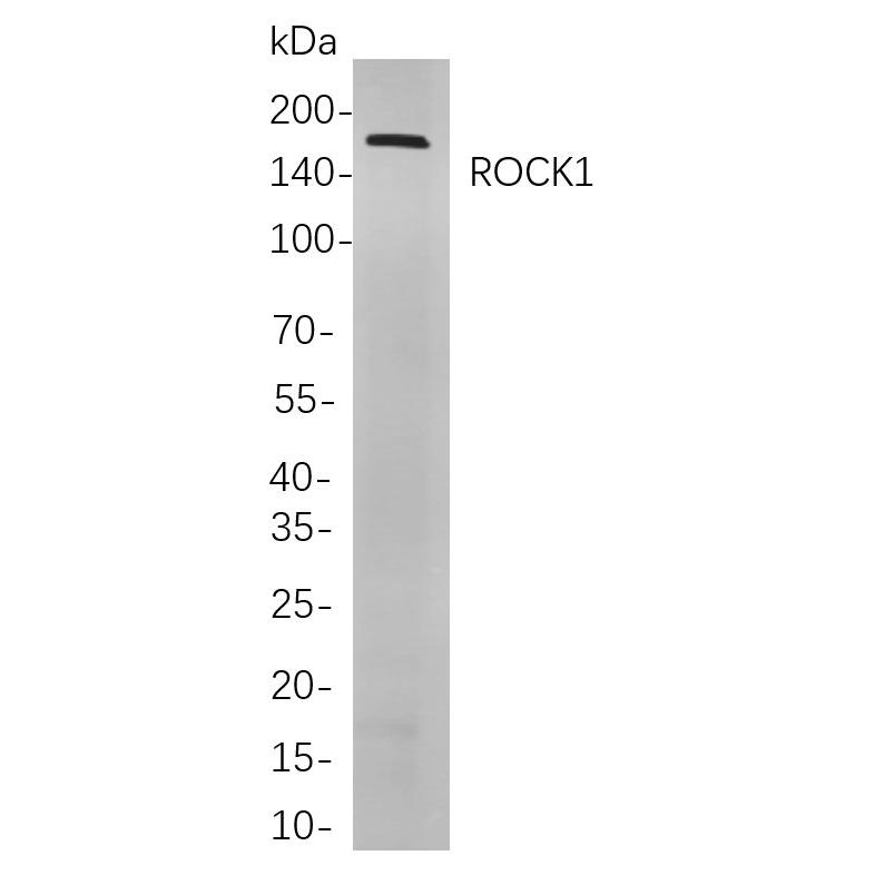 WR4158 Western blot analysis of lysates from C6 cells, using ROCK1 Rabbit mAb. The HRP-conjugated Goat anti-Rabbit IgG antibody (WS0002) was used to detect the antibody. Western blot analysis of lysates from C6 cells, using ROCK1 Rabbit mAb. The HRP-conjugated Goat anti-Rabbit IgG antibody (WS0002) was used to detect the antibody.
