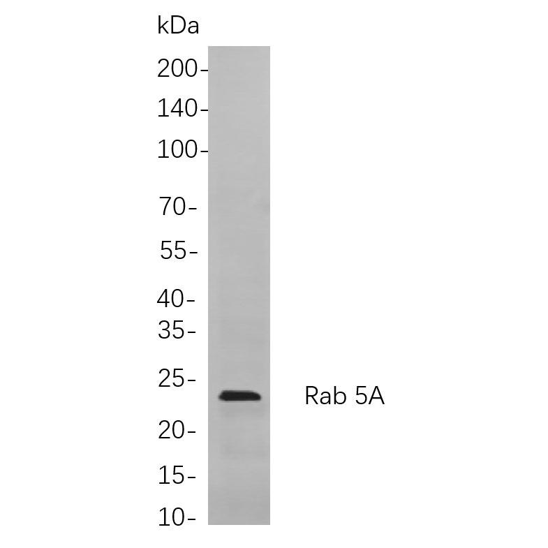 WR4161 Western blot analysis of lysates from HepG2 cells, using Rab 5A Rabbit mAb. The HRP-conjugated Goat anti-Rabbit IgG antibody (WS0002) was used to detect the antibody. Western blot analysis of lysates from HepG2 cells, using Rab 5A Rabbit mAb. The HRP-conjugated Goat anti-Rabbit IgG antibody (WS0002) was used to detect the antibody.