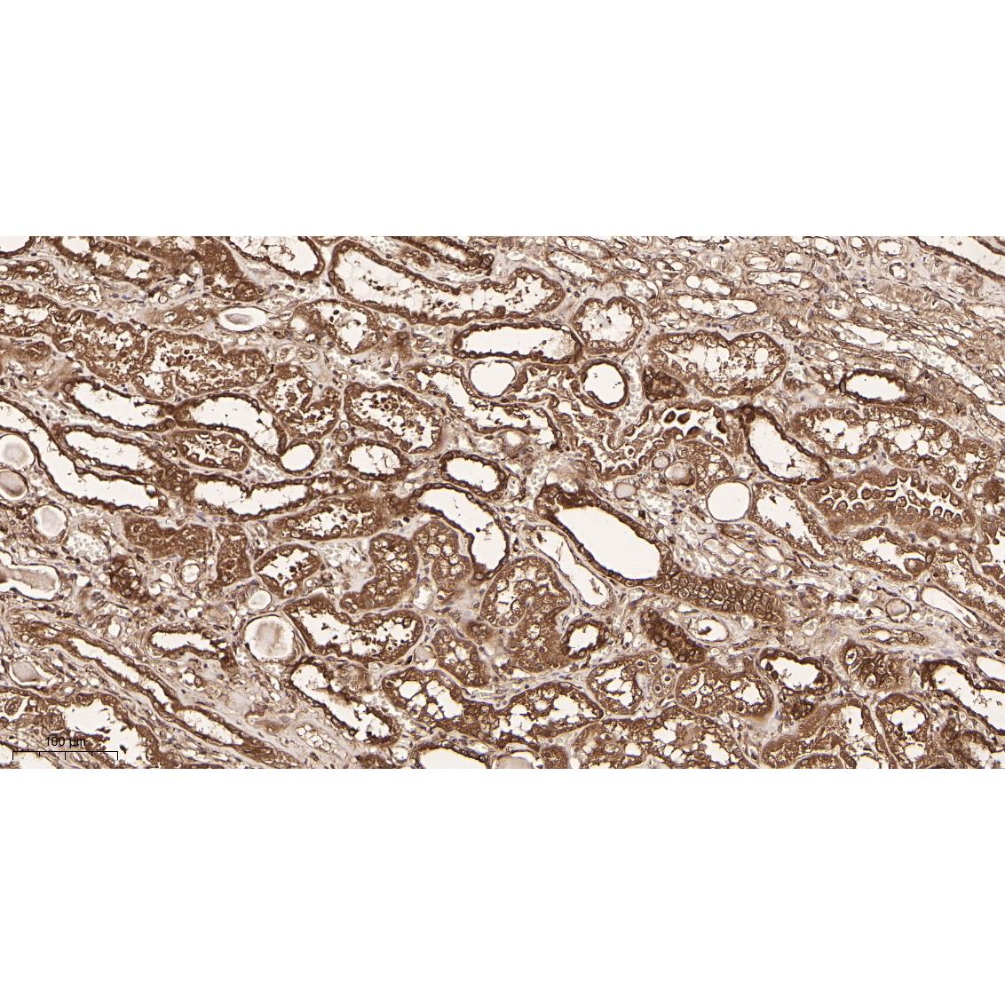 WR4161 Immunohistochemical analysis of paraffin-embedded Human kidney tissue. 1, primary Antibody was diluted at 1:200(4~C,overnight). 2, EDTA pH 9.0 was used for antibody retrieval(>98~C,20min). 3,Secondary antibody was diluted at 1:200(room tempeRature, 30min). Immunohistochemical analysis of paraffin-embedded Human kidney tissue. 1, primary Antibody was diluted at 1:200(4~C,overnight). 2, EDTA pH 9.0 was used for antibody retrieval(>98~C,20min). 3,Secondary antibody was diluted at 1:200(room tempeRature, 30min).