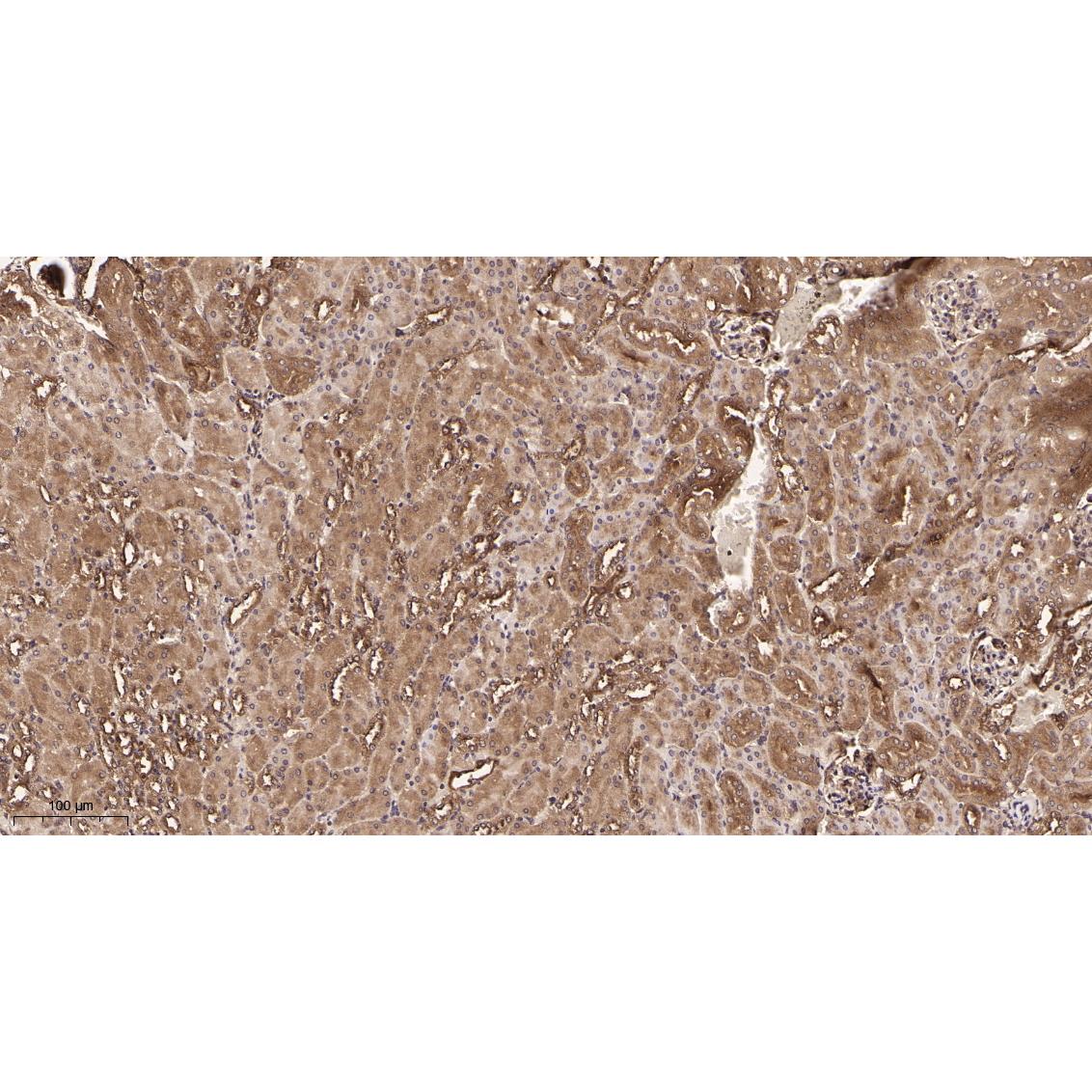 WR4161 Immunohistochemical analysis of paraffin-embedded Mouse kidney tissue. 1, primary Antibody was diluted at 1:200(4~C,overnight). 2, EDTA pH 9.0 was used for antibody retrieval(>98~C,20min). 3,Secondary antibody was diluted at 1:200(room tempeRature, 30min). Immunohistochemical analysis of paraffin-embedded Mouse kidney tissue. 1, primary Antibody was diluted at 1:200(4~C,overnight). 2, EDTA pH 9.0 was used for antibody retrieval(>98~C,20min). 3,Secondary antibody was diluted at 1:200(room tempeRature, 30min).