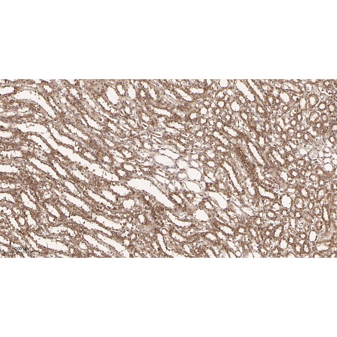 WR4161 Immunohistochemical analysis of paraffin-embedded Rat kidney tissue. 1, primary Antibody was diluted at 1:200(4~C,overnight). 2, EDTA pH 9.0 was used for antibody retrieval(>98~C,20min). 3,Secondary antibody was diluted at 1:200(room tempeRature, 30min). Immunohistochemical analysis of paraffin-embedded Rat kidney tissue. 1, primary Antibody was diluted at 1:200(4~C,overnight). 2, EDTA pH 9.0 was used for antibody retrieval(>98~C,20min). 3,Secondary antibody was diluted at 1:200(room tempeRature, 30min).