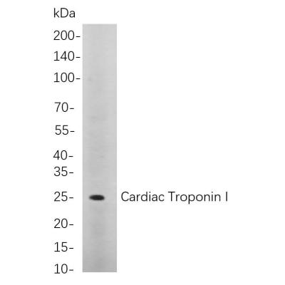 Western blot analysis of lysates from Rat heart cells, using Cardiac Troponin I Rabbit mAb. The HRP-conjugated Goat anti-Rabbit IgG antibody (WS0002) was used to detect the antibody.