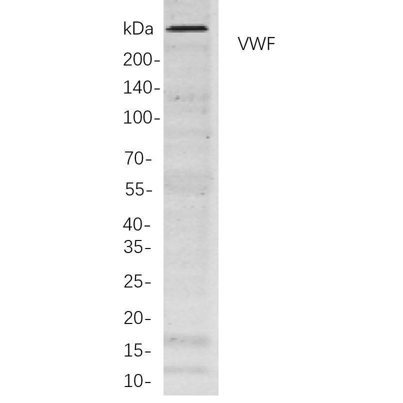 WR4166 Western blot analysis of lysates from HepG2 cells, using VWF Rabbit mAb. The HRP-conjugated Goat anti-Rabbit IgG antibody (WS0002) was used to detect the antibody. Western blot analysis of lysates from HepG2 cells, using VWF Rabbit mAb. The HRP-conjugated Goat anti-Rabbit IgG antibody (WS0002) was used to detect the antibody.