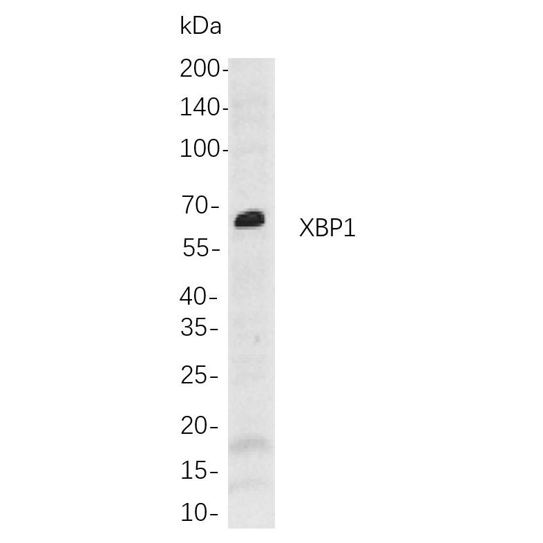 WR4167 Western blot analysis of lysates from A549 cells, using XBP1 Rabbit mAb. The HRP-conjugated Goat anti-Rabbit IgG antibody (WS0002) was used to detect the antibody. Western blot analysis of lysates from A549 cells, using XBP1 Rabbit mAb. The HRP-conjugated Goat anti-Rabbit IgG antibody (WS0002) was used to detect the antibody.