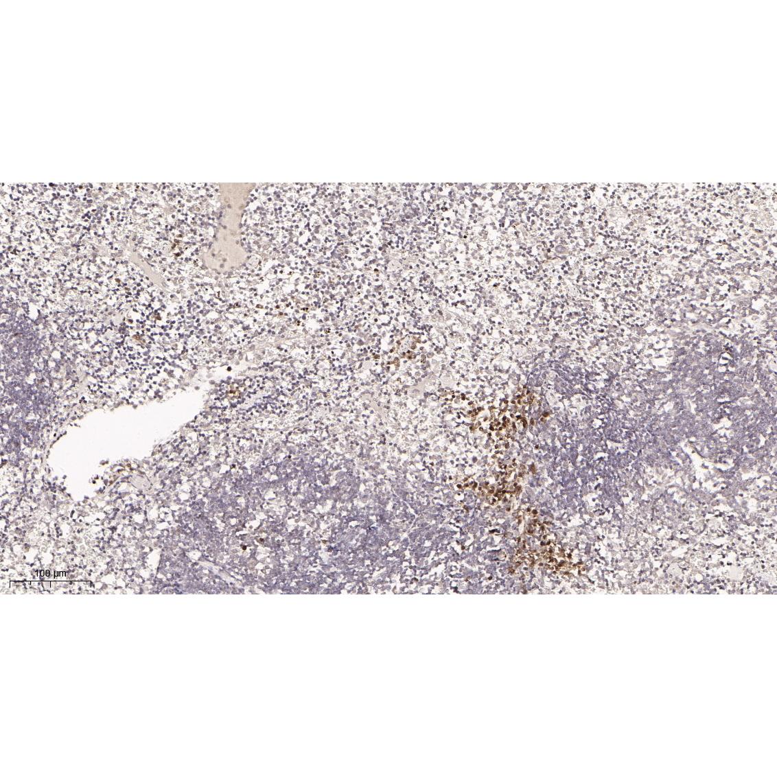WR4167 Immunohistochemical analysis of paraffin-embedded Mouse spleen tissue. 1, primary Antibody was diluted at 1:200(4~C,overnight). 2, EDTA pH 9.0 was used for antibody retrieval(>98~C,20min). 3,Secondary antibody was diluted at 1:200(room tempeRature, 30min). Immunohistochemical analysis of paraffin-embedded Mouse spleen tissue. 1, primary Antibody was diluted at 1:200(4~C,overnight). 2, EDTA pH 9.0 was used for antibody retrieval(>98~C,20min). 3,Secondary antibody was diluted at 1:200(room tempeRature, 30min).