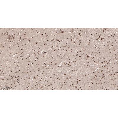 Immunohistochemical analysis of paraffin-embedded human brain tissue. 1, primary Antibody was diluted at 1:200(4～C,overnight). 2, EDTA pH 9.0 was used for antibody retrieval(>98～C,20min). 3,Secondary antibody was diluted at 1:200(room tempeRature, 30min).