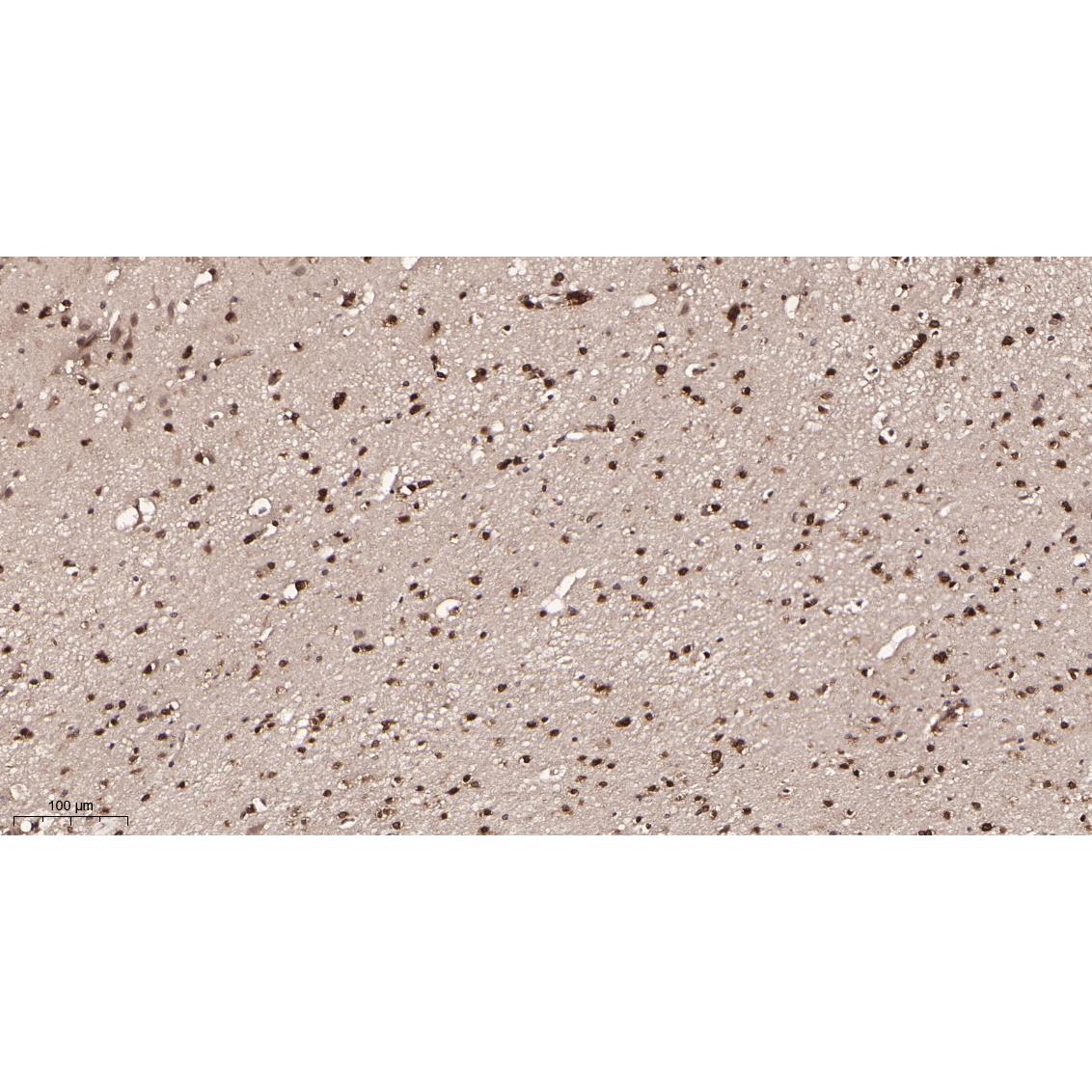 WR4170 Immunohistochemical analysis of paraffin-embedded human brain tissue. 1, primary Antibody was diluted at 1:200(4~C,overnight). 2, EDTA pH 9.0 was used for antibody retrieval(>98~C,20min). 3,Secondary antibody was diluted at 1:200(room tempeRature, 30min). Immunohistochemical analysis of paraffin-embedded human brain tissue. 1, primary Antibody was diluted at 1:200(4~C,overnight). 2, EDTA pH 9.0 was used for antibody retrieval(>98~C,20min). 3,Secondary antibody was diluted at 1:200(room tempeRature, 30min).