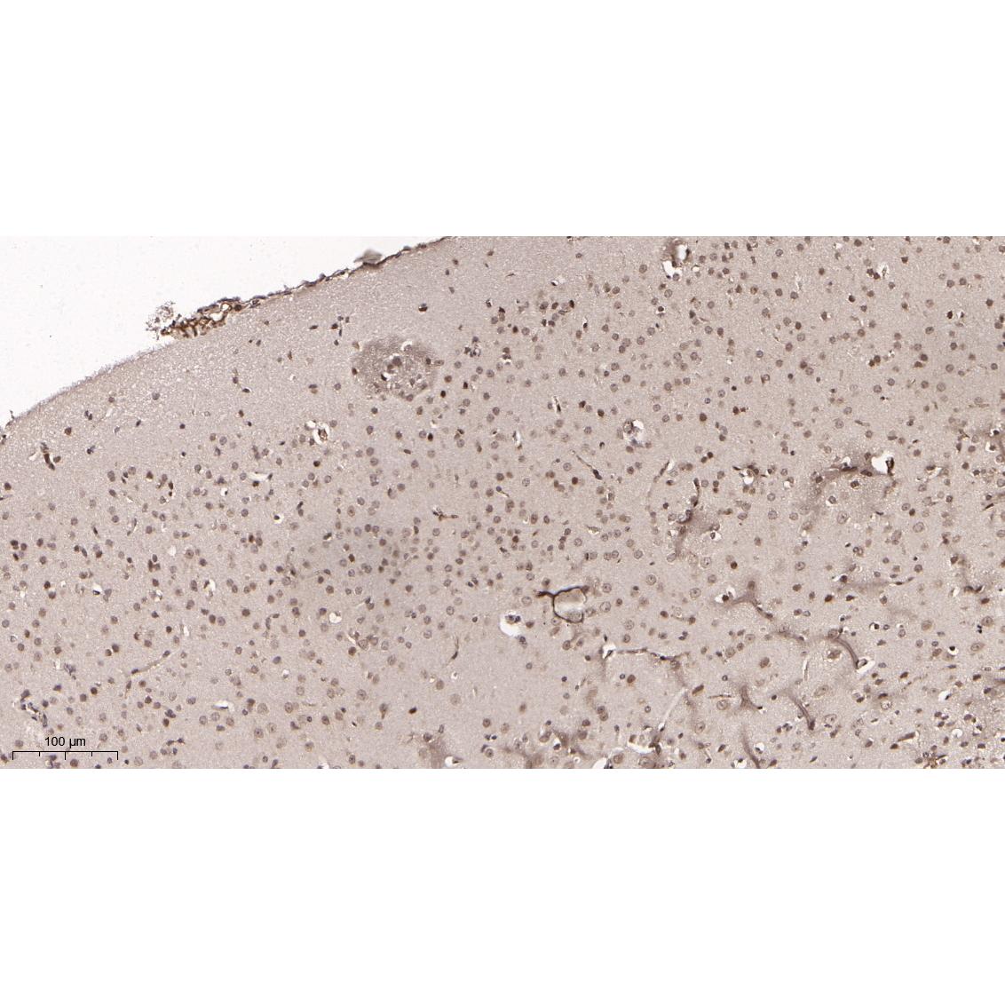 WR4170 Immunohistochemical analysis of paraffin-embedded mouse brain tissue. 1, primary Antibody was diluted at 1:200(4~C,overnight). 2, EDTA pH 9.0 was used for antibody retrieval(>98~C,20min). 3,Secondary antibody was diluted at 1:200(room tempeRature, 30min). Immunohistochemical analysis of paraffin-embedded mouse brain tissue. 1, primary Antibody was diluted at 1:200(4~C,overnight). 2, EDTA pH 9.0 was used for antibody retrieval(>98~C,20min). 3,Secondary antibody was diluted at 1:200(room tempeRature, 30min).