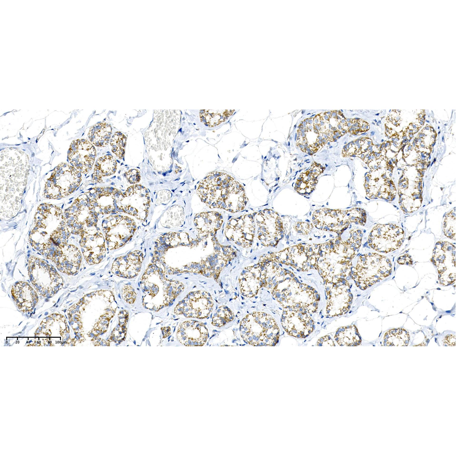 WR4172 Rat mammary gland WR4172 Rat mammary gland