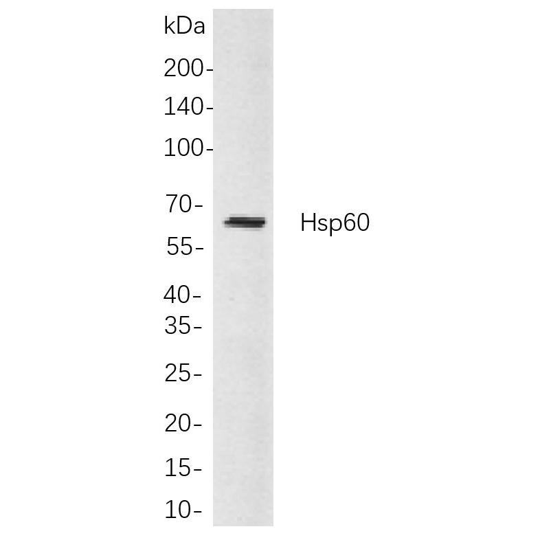 WR4172 Hela whole cell lysates were separated by 10% SDS-PAGE, and the membrane was blotted with primary antibody(1:1000). The HRP-conjugated Goat anti-Rabbit IgG(H + L) antibody was used to detect the antibody. Hela whole cell lysates were separated by 10% SDS-PAGE, and the membrane was blotted with primary antibody(1:1000). The HRP-conjugated Goat anti-Rabbit IgG(H + L) antibody was used to detect the antibody.