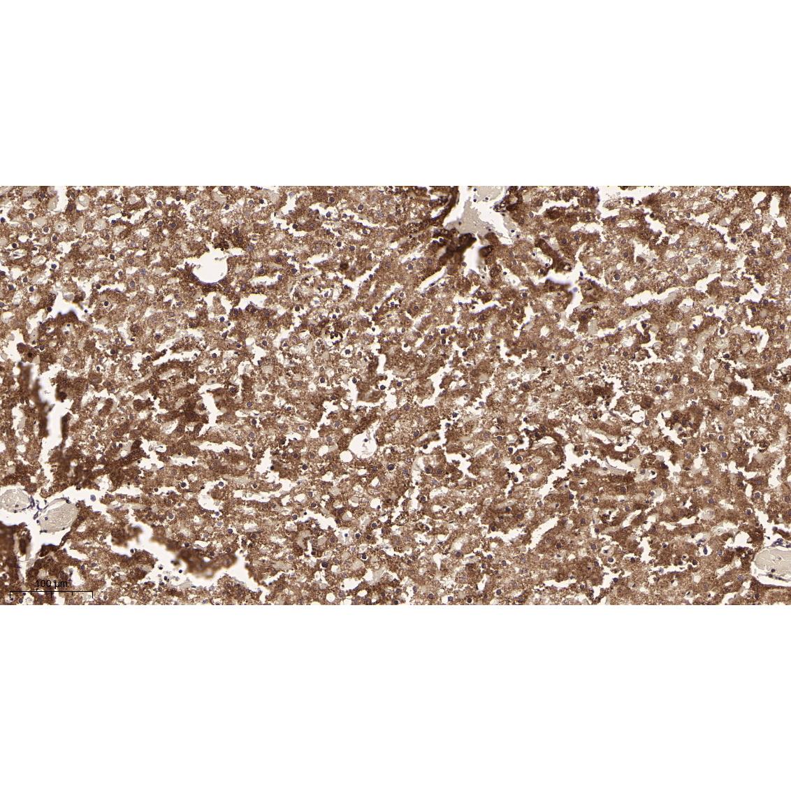 WR4172Immunohistochemical analysis of paraffin-embedded Rat liver tissue. 1, primary Antibody was diluted at 1:200(4~C,overnight). 2, EDTA pH 9.0 was used for antibody retrieval(>98~C,20min). 3,Secondary antibody was diluted at 1:200(room tempeRature, 30min). Immunohistochemical analysis of paraffin-embedded Rat liver tissue. 1, primary Antibody was diluted at 1:200(4~C,overnight). 2, EDTA pH 9.0 was used for antibody retrieval(>98~C,20min). 3,Secondary antibody was diluted at 1:200(room tempeRature, 30min).