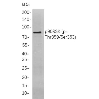 Western blot analysis of lysates from K562 cells, using p90RSK (p-Thr359/Ser363) Rabbit mAb. The HRP-conjugated Goat anti-Rabbit IgG antibody (WS0002) was used to detect the antibody.