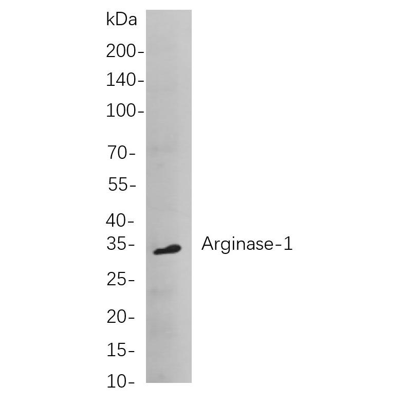 WR4193 Western blot analysis of lysates from huh-7 cells, using Arginase-1 Rabbit mAb. The HRP-conjugated Goat anti-Rabbit IgG antibody (WS0002) was used to detect the antibody. Western blot analysis of lysates from huh-7 cells, using Arginase-1 Rabbit mAb. The HRP-conjugated Goat anti-Rabbit IgG antibody (WS0002) was used to detect the antibody.