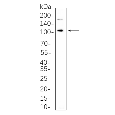 LnCap whole cell lysates were separated by 10% SDS-PAGE, and the membrane was blotted with primary antibody(1:1000). The HRP-conjugated Goat anti-Rabbit IgG(H + L) antibody was used to detect the antibody.