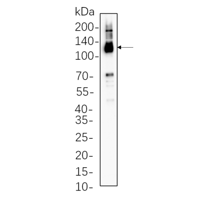 HEK293 cell lysates were separated by 4-20% SDS-PAGE, and the membrane was blotted with primary antibody 1:1000. The HRP-conjugated Goat anti-Rabbit IgG(H + L) antibody was used to detect the antibody.