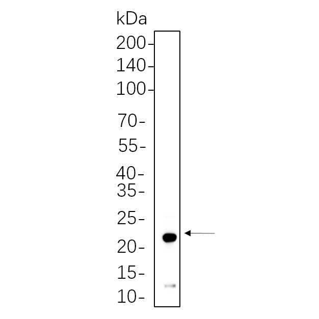 WR4197 Hela cell lysates were separated by 4-20% SDS-PAGE, and the membrane was blotted with primary antibody 1:1000. The HRP-conjugated Goat anti-Rabbit IgG(H + L) antibody was used to detect the antibody. Hela cell lysates were separated by 4-20% SDS-PAGE, and the membrane was blotted with primary antibody 1:1000. The HRP-conjugated Goat anti-Rabbit IgG(H + L) antibody was used to detect the antibody.