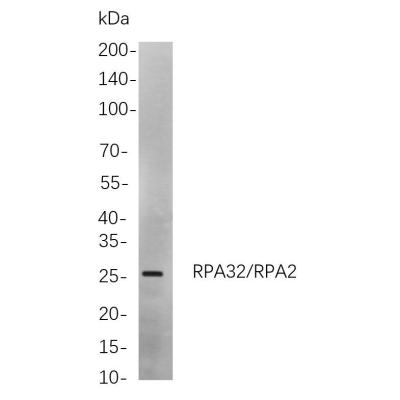 Western blot analysis of lysates from Jurkat cells, using RPA32/RPA2 Rabbit mAb. The HRP-conjugated Goat anti-Rabbit IgG antibody (WS0002) was used to detect the antibody.