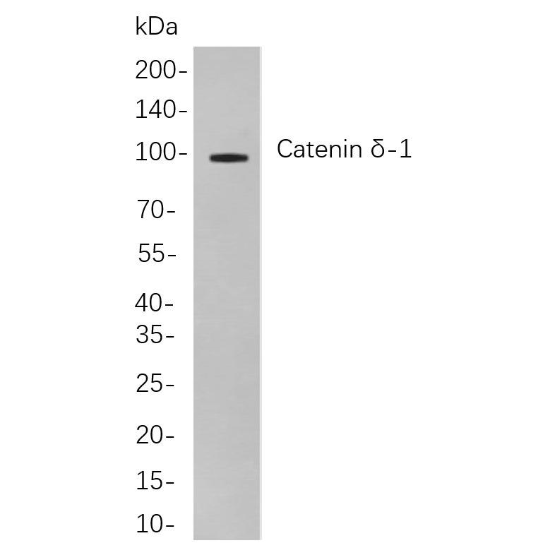 WR4211 Western blot analysis of lysates from 3T3-L1 cells, using Catenin δ-1 Rabbit mAb. The HRP-conjugated Goat anti-Rabbit IgG antibody (WS0002) was used to detect the antibody. Western blot analysis of lysates from 3T3-L1 cells, using Catenin δ-1 Rabbit mAb. The HRP-conjugated Goat anti-Rabbit IgG antibody (WS0002) was used to detect the antibody.