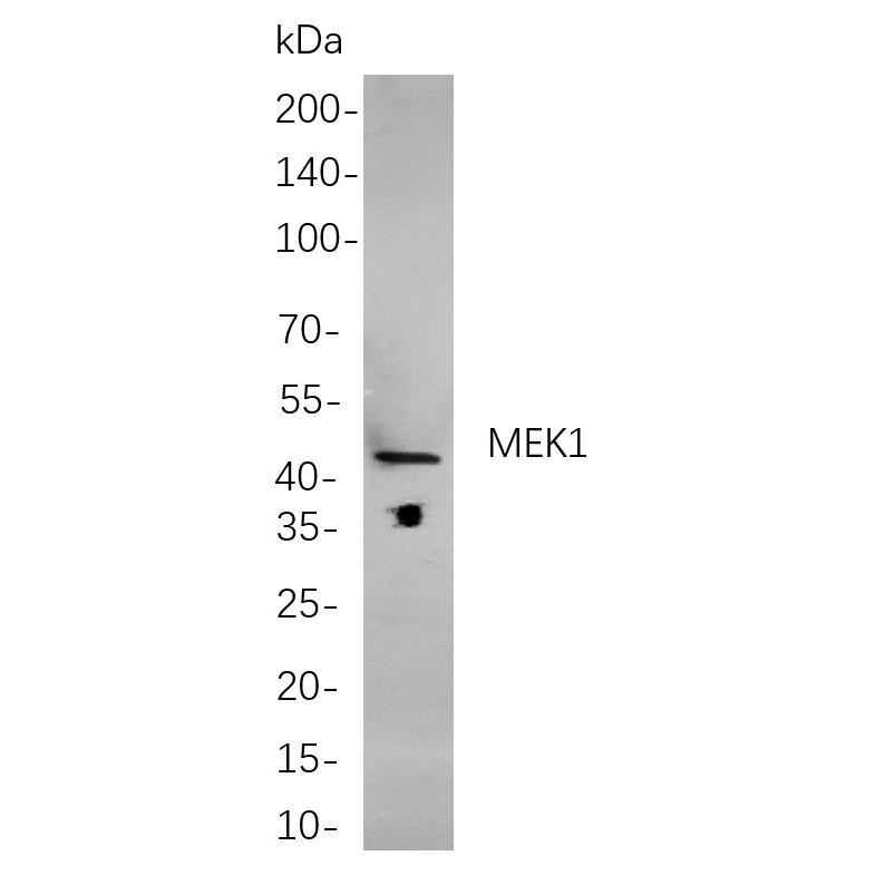 WR4213 Western blot analysis of lysates from A431 cells, using MEK1 Rabbit mAb. The HRP-conjugated Goat anti-Rabbit IgG antibody (WS0002) was used to detect the antibody. Western blot analysis of lysates from A431 cells, using MEK1 Rabbit mAb. The HRP-conjugated Goat anti-Rabbit IgG antibody (WS0002) was used to detect the antibody.