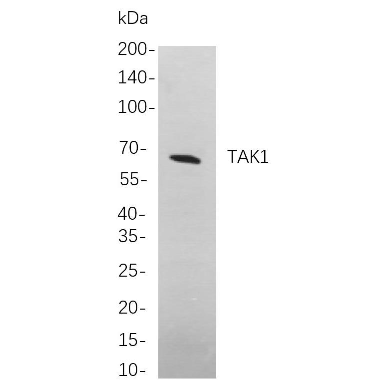 WR4218 Western blot analysis of lysates from A431 cells, using TAK1 Rabbit mAb. The HRP-conjugated Goat anti-Rabbit IgG antibody (WS0002) was used to detect the antibody. Western blot analysis of lysates from A431 cells, using TAK1 Rabbit mAb. The HRP-conjugated Goat anti-Rabbit IgG antibody (WS0002) was used to detect the antibody.