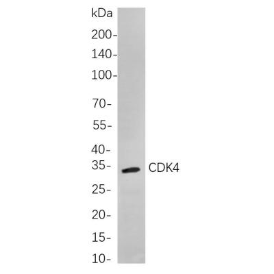 Western blot analysis of lysates from HepG2 cells, using PCNA Rabbit mAb. The HRP-conjugated Goat anti-Rabbit IgG antibody (WS0002) was used to detect the antibody.