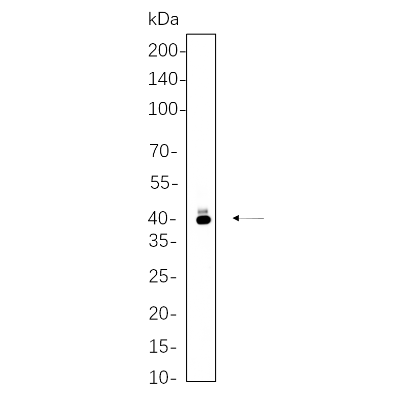 WR4221 Ramos cell lysates were separated by 4-20% SDS-PAGE, and the membrane was blotted with primary antibody 1:1000. The HRP-conjugated Goat anti-Rabbit IgG(H + L) antibody was used to detect the antibody. Ramos cell lysates were separated by 4-20% SDS-PAGE, and the membrane was blotted with primary antibody 1:1000. The HRP-conjugated Goat anti-Rabbit IgG(H + L) antibody was used to detect the antibody.