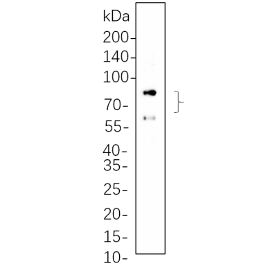 HaCat cell lysates were separated by 4-20% SDS-PAGE, and the membrane was blotted with primary antibody 1:1000. The HRP-conjugated Goat anti-Rabbit IgG(H + L) antibody was used to detect the antibody.