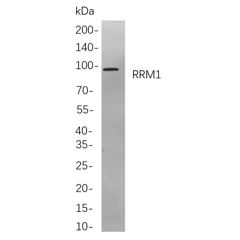 β Catenin (Phospho Ser675) Rabbit mAb [PT0872R] - Ucallm