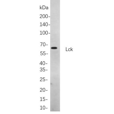 Western blot analysis of lysates from Jurkat cells, using Lck Rabbit mAb. The HRP-conjugated Goat anti-Rabbit IgG antibody (WS0002) was used to detect the antibody.