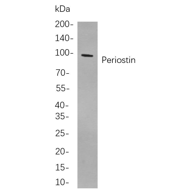 WR4239 Western blot analysis of lysates from T47D cells, using Periostin Rabbit mAb. The HRP-conjugated Goat anti-Rabbit IgG antibody (WS0002) was used to detect the antibody. Western blot analysis of lysates from T47D cells, using Periostin Rabbit mAb. The HRP-conjugated Goat anti-Rabbit IgG antibody (WS0002) was used to detect the antibody.