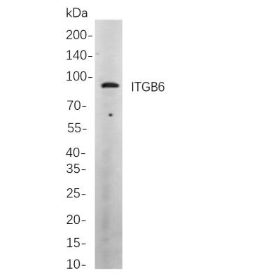 Western blot analysis of lysates from Hela cells, using ITGB6 Rabbit mAb. The HRP-conjugated Goat anti-Rabbit IgG antibody (WS0002) was used to detect the antibody.