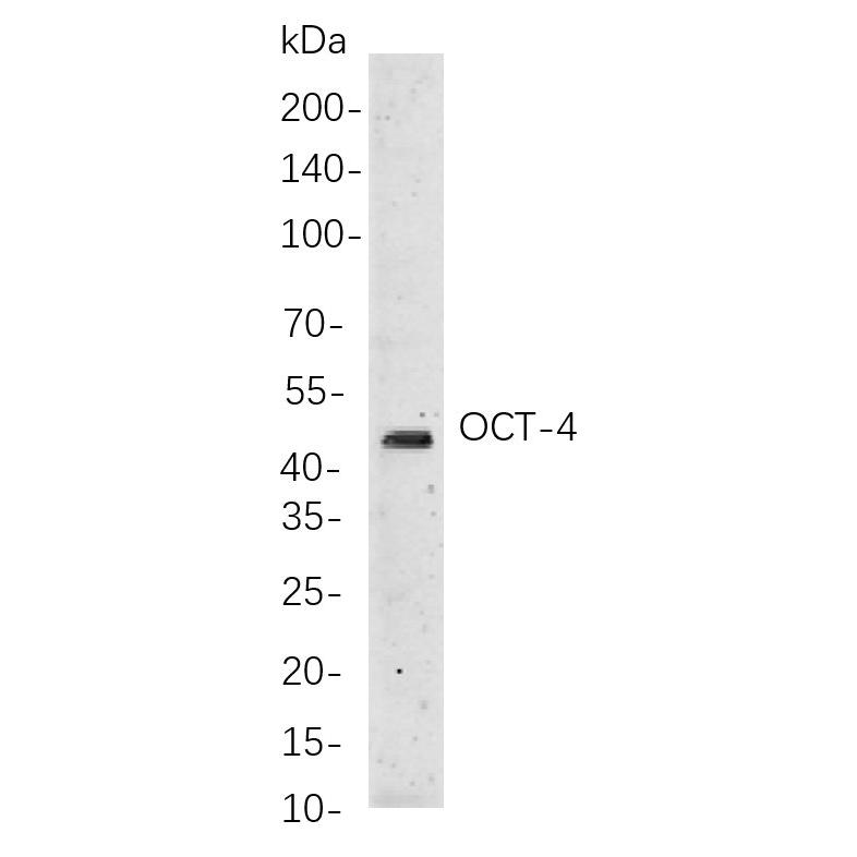 WR4246 Western blot analysis of lysates from NCCIT cells, using 45569 Rabbit mAb. The HRP-conjugated Goat anti-Rabbit IgG antibody (WS0002) was used to detect the antibody. Western blot analysis of lysates from NCCIT cells, using 45569 Rabbit mAb. The HRP-conjugated Goat anti-Rabbit IgG antibody (WS0002) was used to detect the antibody.