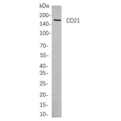 Western blot analysis of lysates from Raji cells, using CD21 Rabbit mAb. The HRP-conjugated Goat anti-Rabbit IgG antibody (WS0002) was used to detect the antibody.