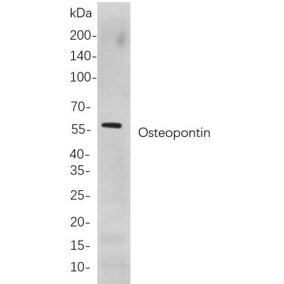 Western blot analysis of lysates from A549 cells, using Osteopontin Rabbit mAb. The HRP-conjugated Goat anti-Rabbit IgG antibody (WS0002) was used to detect the antibody.