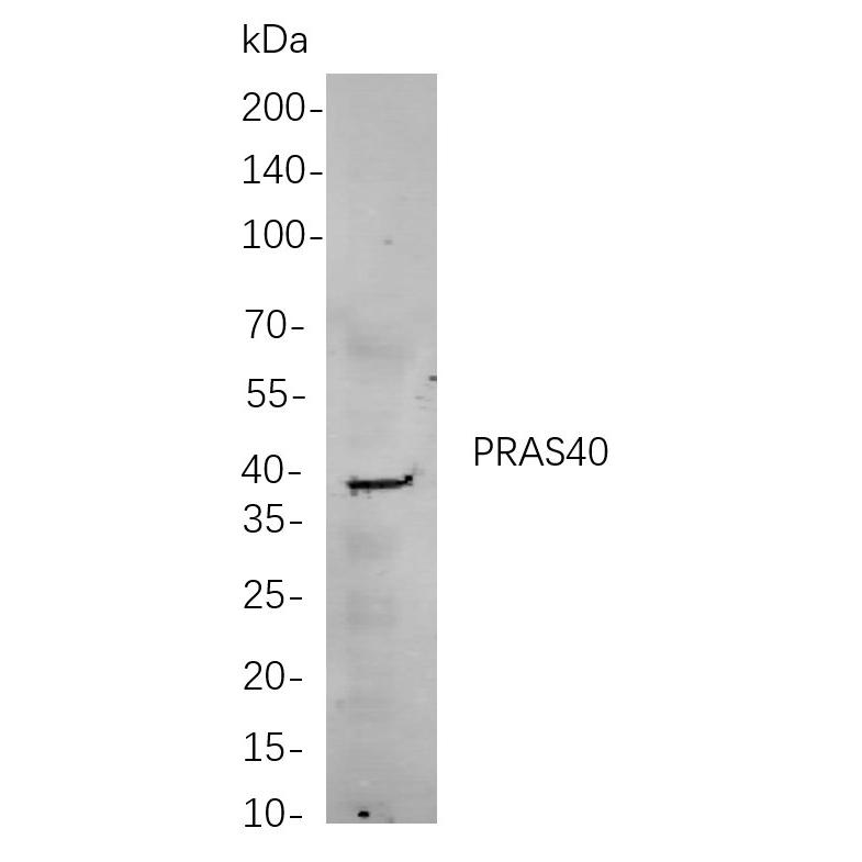 WR4260 Western blot analysis of lysates from A549 cells, using PRAS40 Rabbit mAb. The HRP-conjugated Goat anti-Rabbit IgG antibody (WS0002) was used to detect the antibody. Western blot analysis of lysates from A549 cells, using PRAS40 Rabbit mAb. The HRP-conjugated Goat anti-Rabbit IgG antibody was used to detect the antibody.