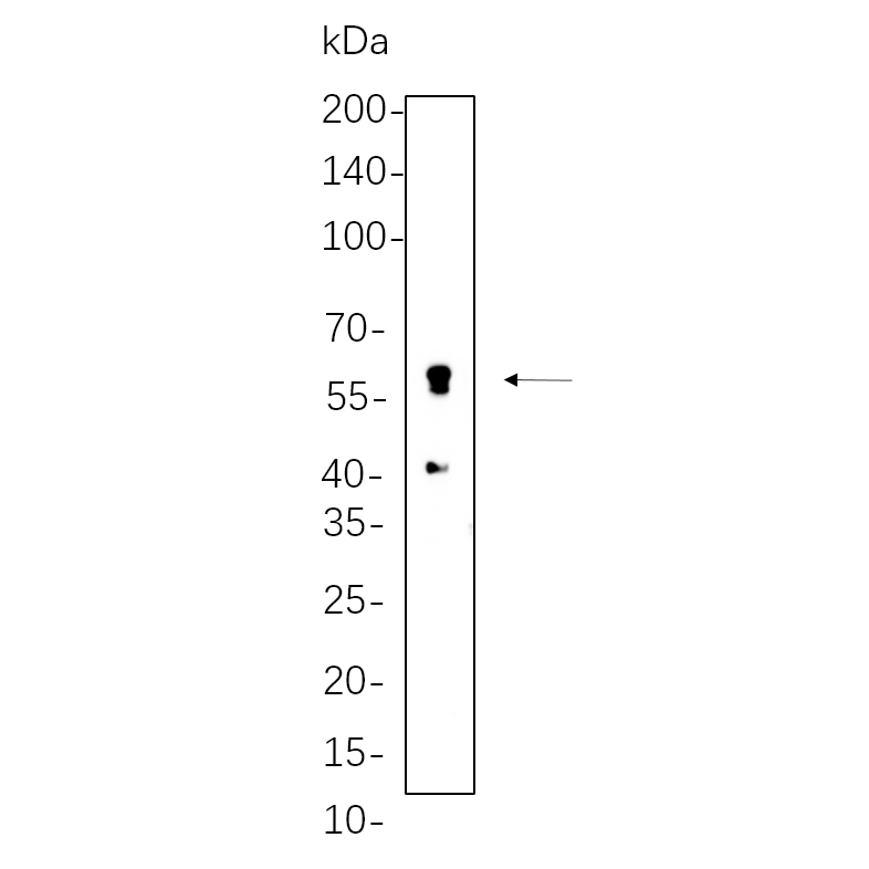 WR4269 Rat fat cell lysates were separated by 4-20% SDS-PAGE, and the membrane was blotted with primary antibody 1:1000. The HRP-conjugated Goat anti-Rabbit IgG(H + L) antibody was used to detect the antibody. Rat fat cell lysates were separated by 4-20% SDS-PAGE, and the membrane was blotted with primary antibody 1:1000. The HRP-conjugated Goat anti-Rabbit IgG(H + L) antibody was used to detect the antibody.