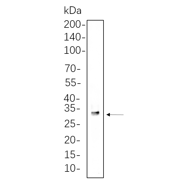 WR4270 K562 cell lysates were separated by 4-20% SDS-PAGE, and the membrane was blotted with primary antibody 1:1000. The HRP-conjugated Goat anti-Rabbit IgG(H + L) antibody was used to detect the antibody. K562 cell lysates were separated by 4-20% SDS-PAGE, and the membrane was blotted with primary antibody 1:1000. The HRP-conjugated Goat anti-Rabbit IgG(H + L) antibody was used to detect the antibody.