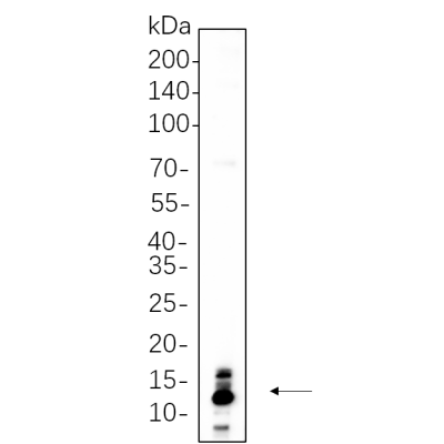 SK-MEL-28 whole cell lysates were separated by 10% SDS-PAGE, and the membrane was blotted with primary antibody(1:1000). The HRP-conjugated Goat anti-Rabbit IgG(H + L) antibody was used to detect the antibody.