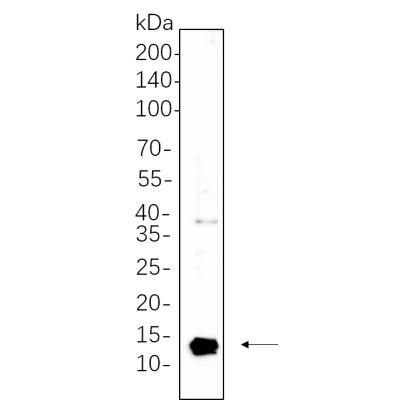 U-251 MG whole cell lysates were separated by 10% SDS-PAGE, and the membrane was blotted with primary antibody(1:1000). The HRP-conjugated Goat anti-Rabbit IgG(H + L) antibody was used to detect the antibody.