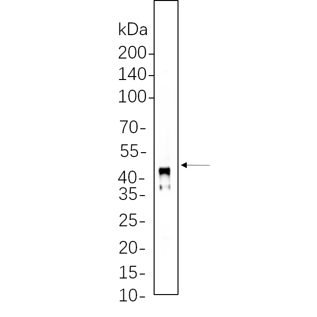 WR4275 Rat womb cell lysates were separated by 4-20% SDS-PAGE, and the membrane was blotted with primary antibody 1:1000. The HRP-conjugated Goat anti-Rabbit IgG(H + L) antibody was used to detect the antibody. Rat womb cell lysates were separated by 4-20% SDS-PAGE, and the membrane was blotted with primary antibody 1:1000. The HRP-conjugated Goat anti-Rabbit IgG(H + L) antibody was used to detect the antibody.