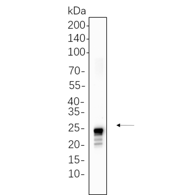 Rat womb cell lysates were separated by 4-20% SDS-PAGE, and the membrane was blotted with primary antibody 1:1000. The HRP-conjugated Goat anti-Rabbit IgG(H + L) antibody was used to detect the antibody.